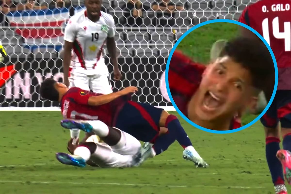 VIDEO: Espeluznante fractura de Warren Madrigal en la Copa Oro 2025