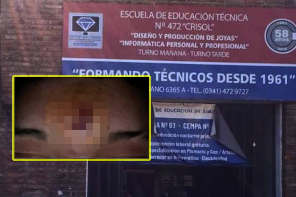 Profesor hiere a alumno en la cabeza tras lanzarle borrador por no callarse en clase; es suspendido por agresión