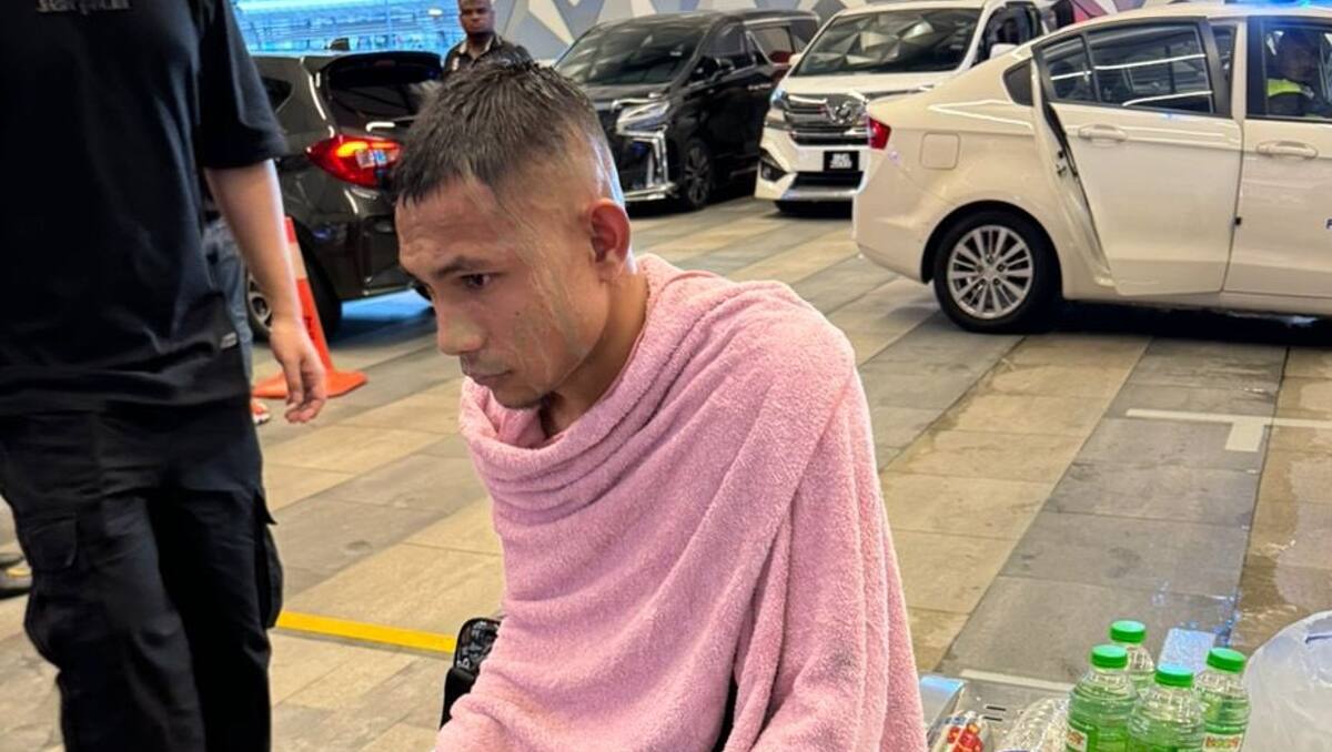 Faisal Halim resultó con grandes heridas tras el ataque con ácido.