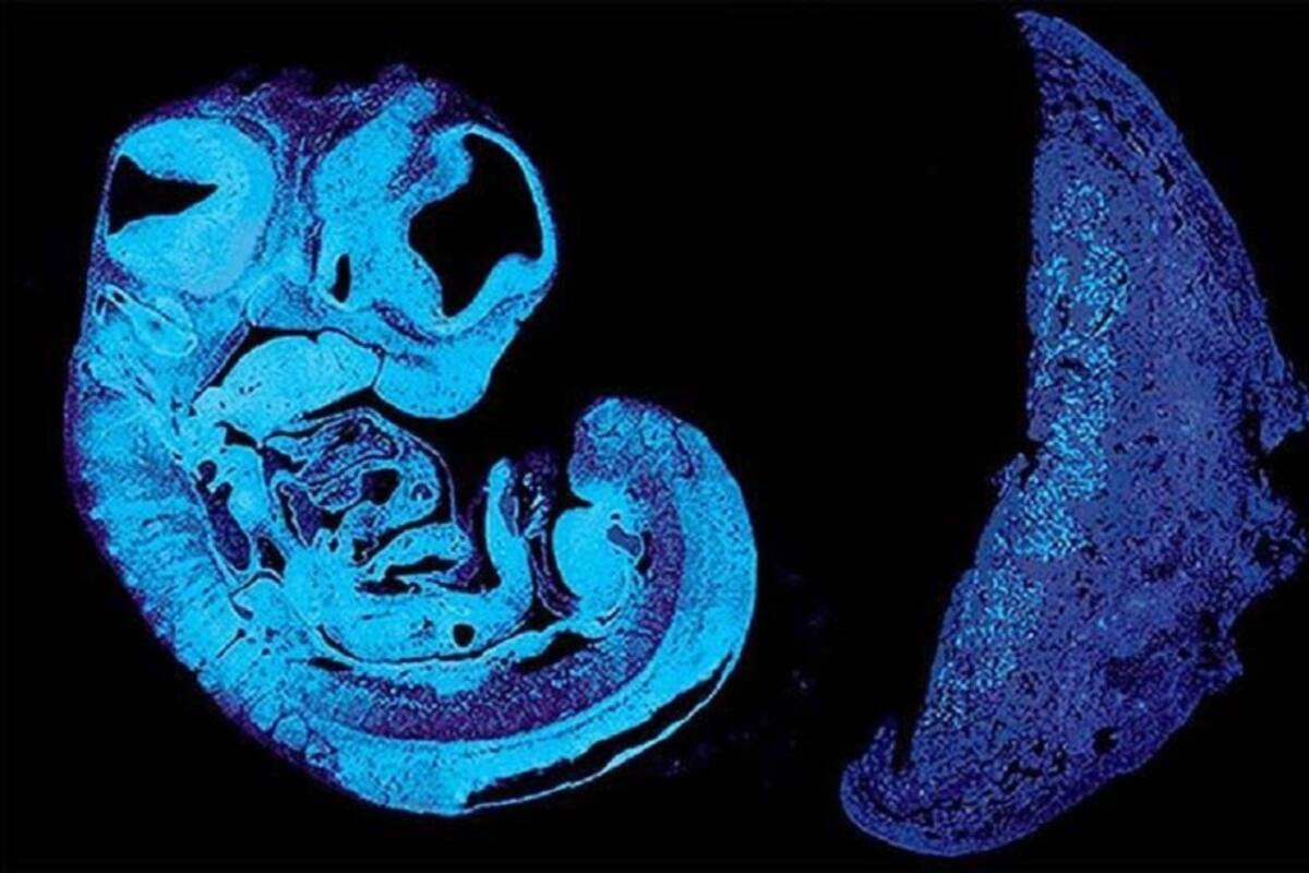 Estudio: Los genes del padre y la madre del feto se pelean por comida en el útero