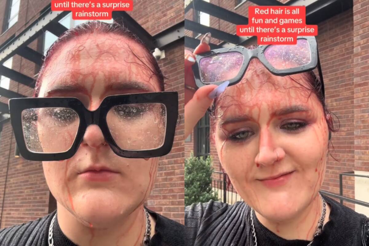 Joven muestra cómo la lluvia le decoloró el tinte: ¡su cara quedó completamente manchada!