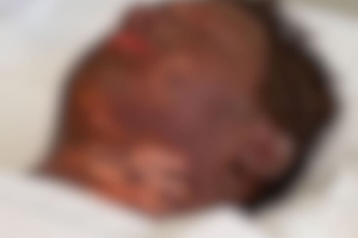 Joven sufre 80% de quemaduras en su cuerpo por descarga eléctrica, su familia pide apoyo