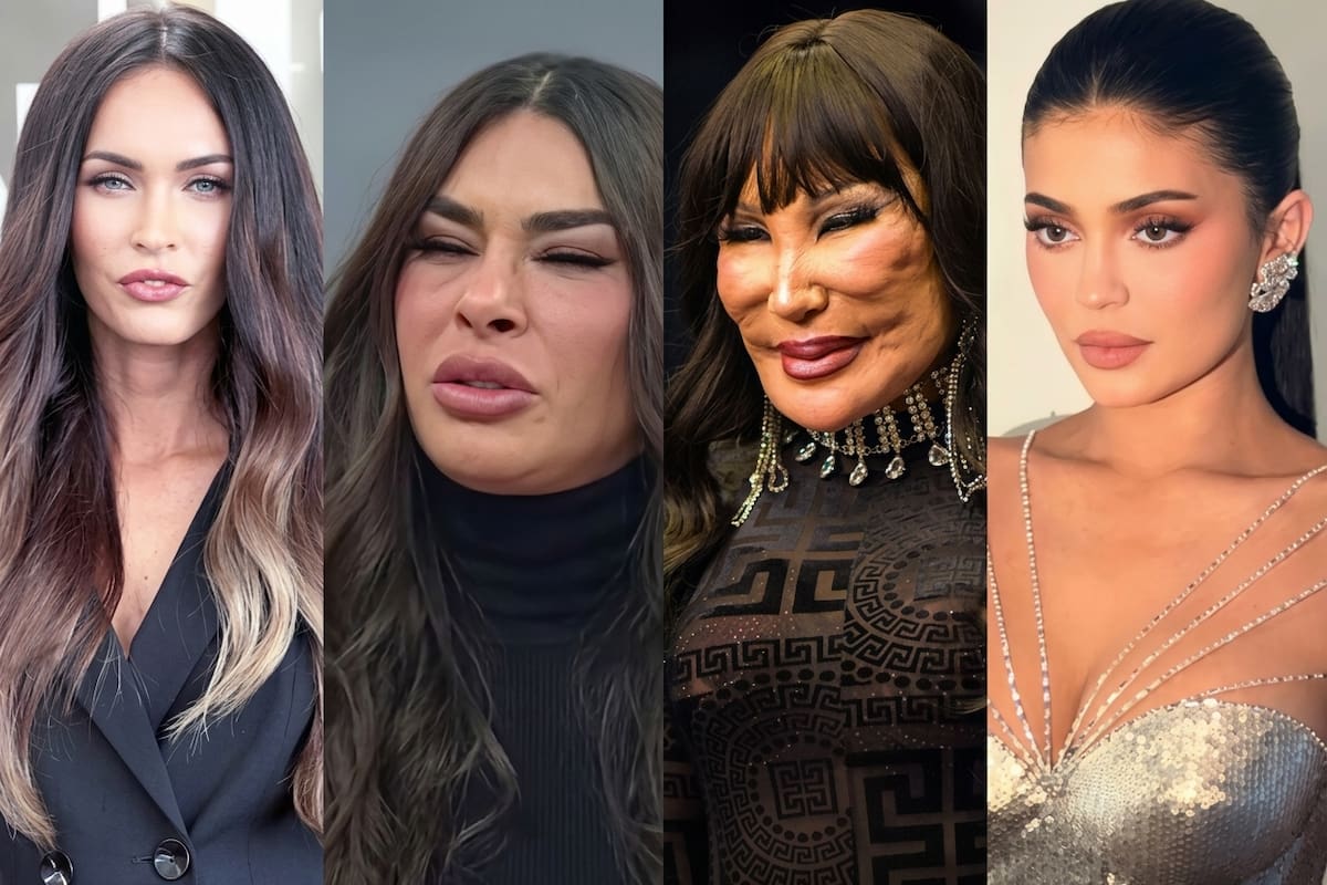 Impactan cirugías la carrera de las famosas