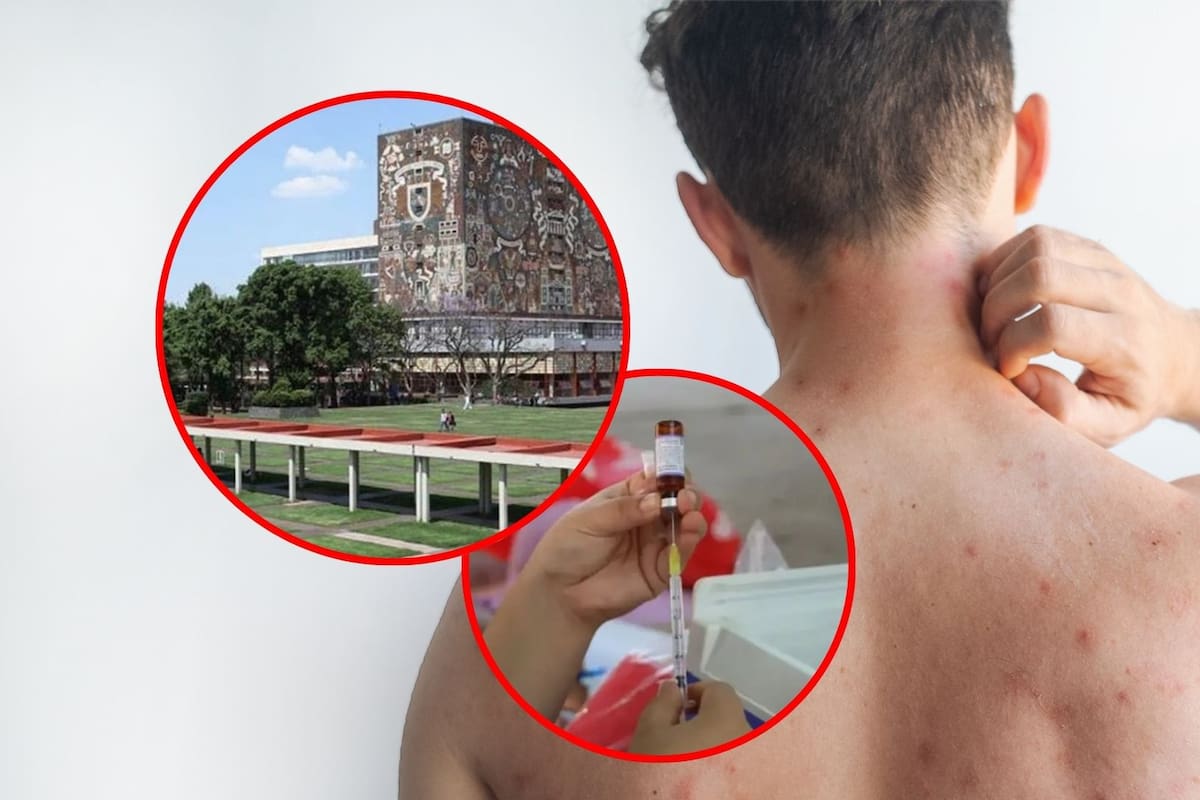 UNAM detecta caso sospechoso de sarampión en la Facultad de Medicina, activa protocolos de vigilancia epidemiológica y refuerza acciones preventivas con apoyo del IMSS