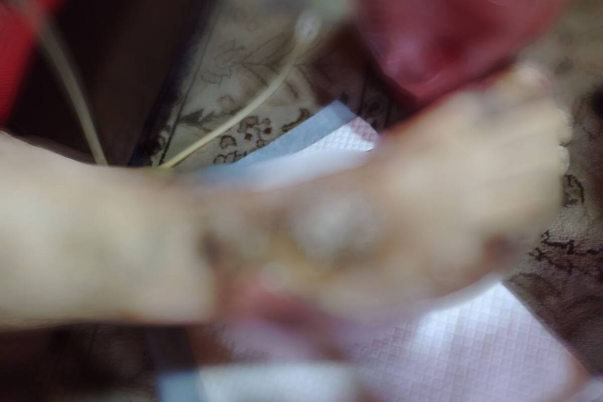 Pide apoyo para salvar la pierna de su esposo