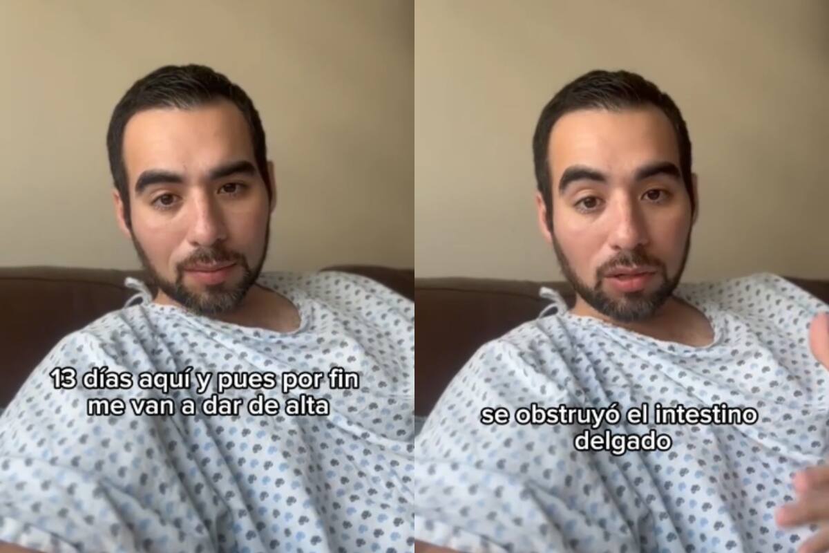 Hombre come una sopa de Costco y termina sin 20 centímetros de su intestino: ¡esto fue lo que le pasó!