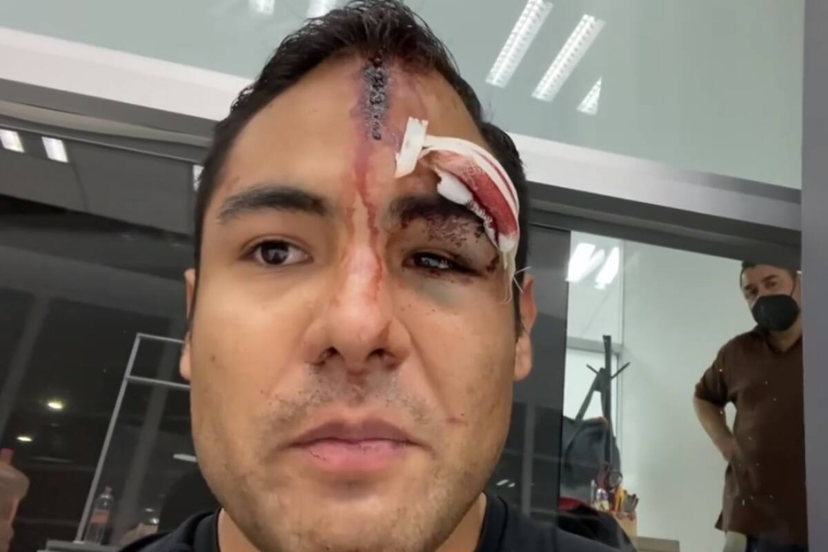 Excolaborador del programa “Hoy” fue brutalmente golpeado con una pistola en la cabeza por sus vecinos