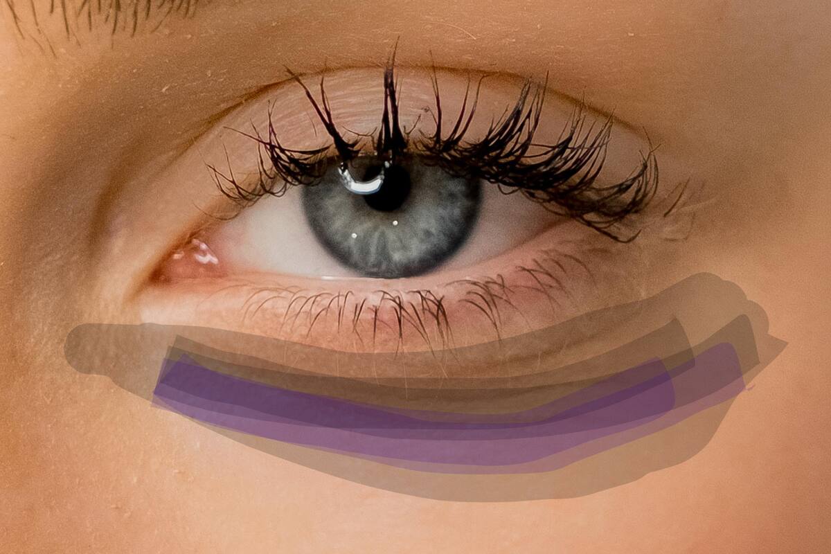 Así puedes reducir las ojeras fácil y rápido