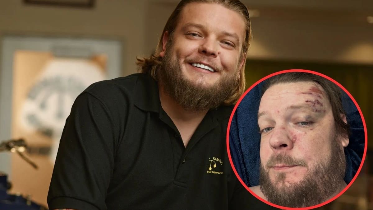 Corey Harrison, de “El Precio de la Historia”, sufre grave accidente en Tulum y pide ayuda tras gastos médicos de más de 100 mil dólares pero su padre Rick asegura que ya pagó la deuda