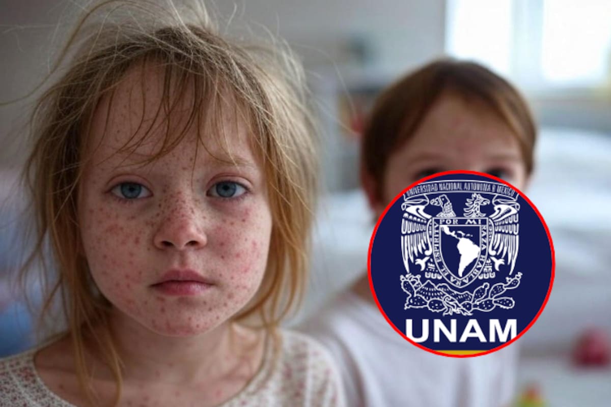 El sarampión resurge en México: La cobertura de vacunación alcanza solo el 70%