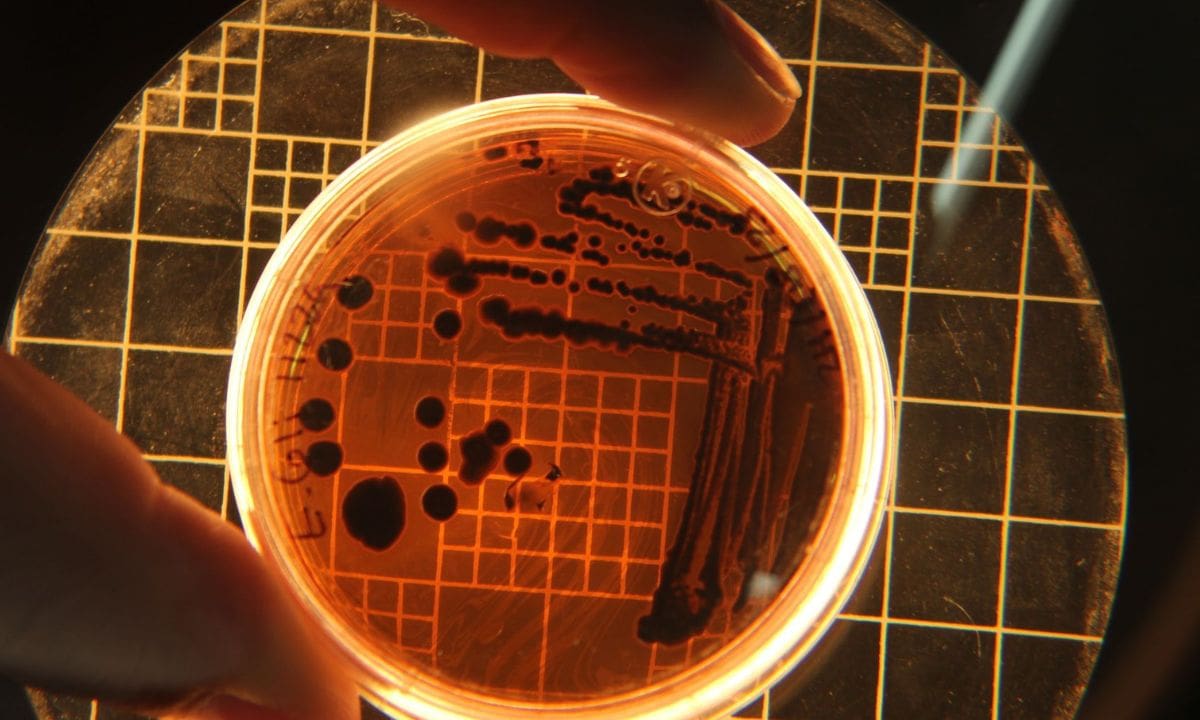 La peste neumónica puede ser mortal si no recibe tratamiento. Por ello, la identificación temprana y la administración de antibióticos son elementos centrales para reducir el riesgo de complicaciones. Foto: Pexels.