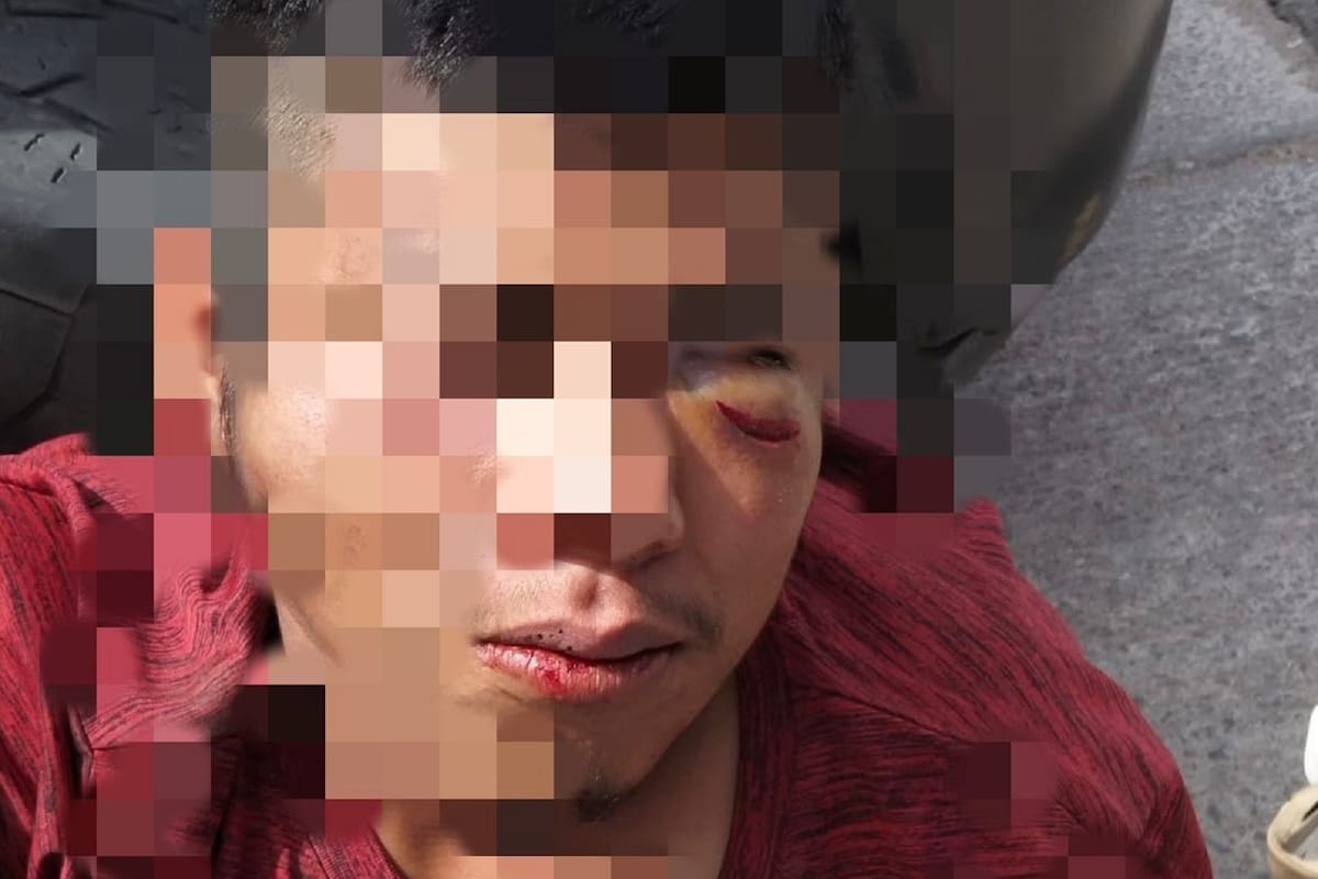 Golpean brutalmente a presunto roba perritos en Rosarito