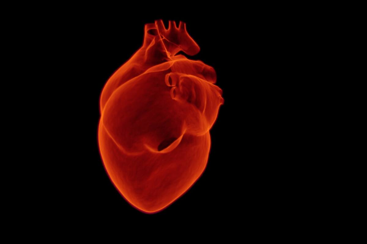 Mortalidad por infarto en México supera al promedio internacional