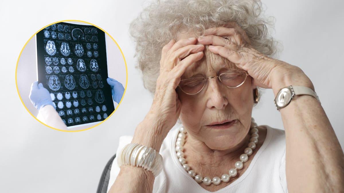 Científicos explican que el Alzheimer no solo depende de genes heredados, sino de marcas químicas en el ADN cerebral que cambian con la enfermedad y afectan su progresión