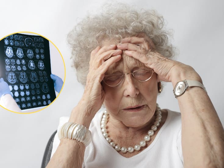Científicos explican que el Alzheimer no solo depende de genes heredados, sino de marcas químicas en el ADN cerebral que cambian con la enfermedad y afectan su progresión