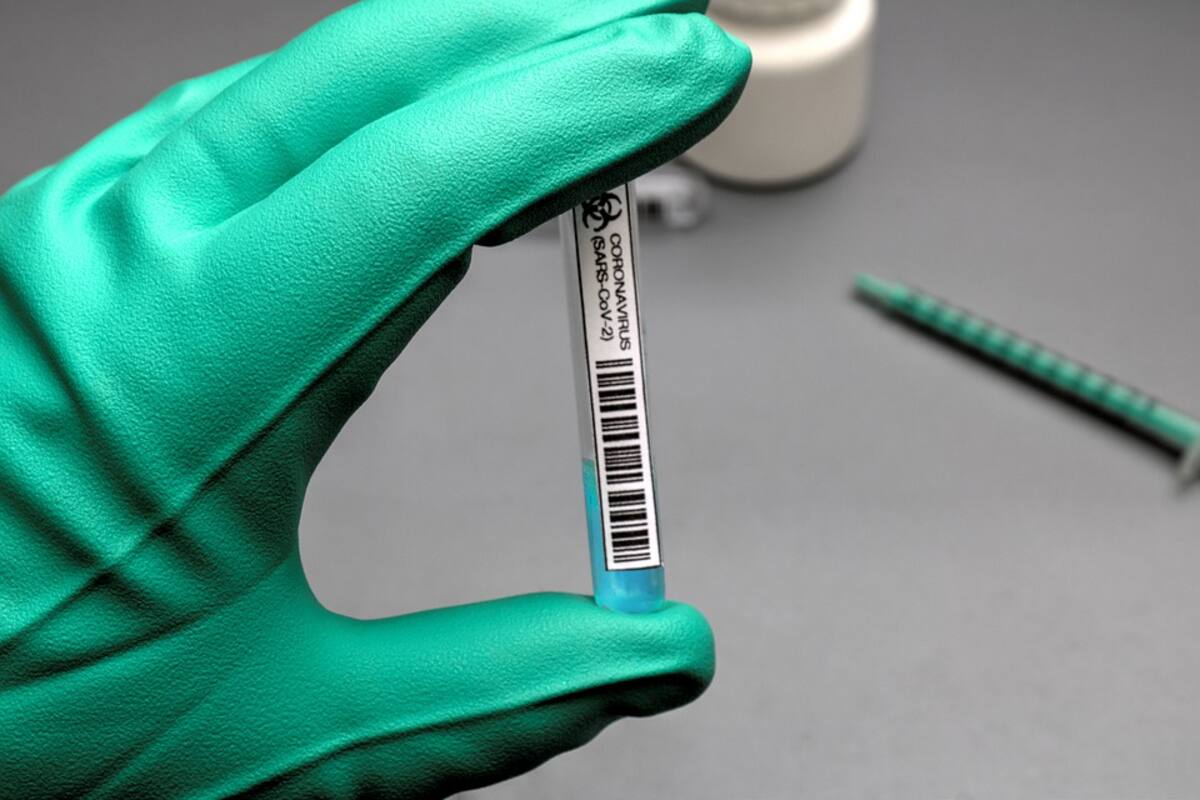 Covid-19 e influenza podrán ser detectados en una sola prueba que llegará a México
