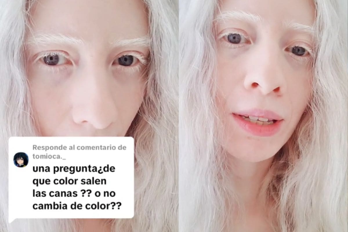 Mujer cuenta cómo son las canas en las personas con albinismo