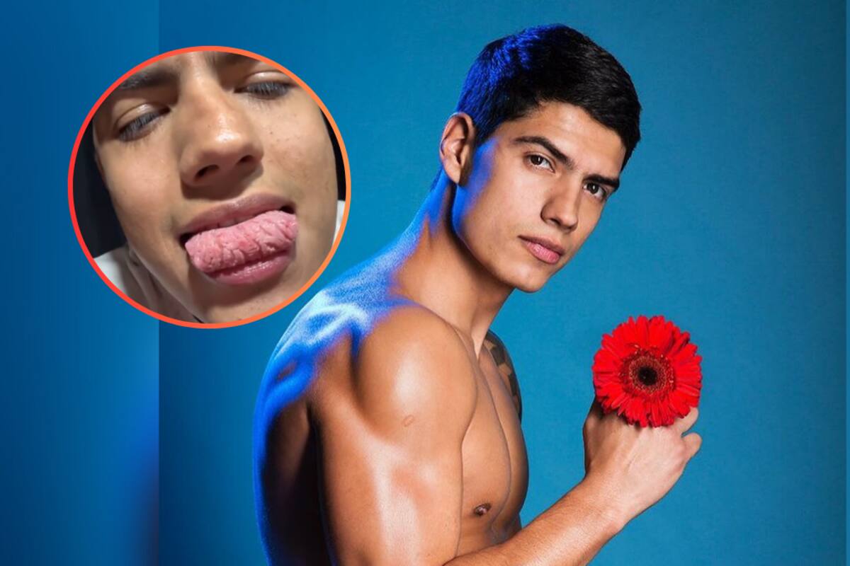 Actor sufre una extraña condición en su lengua: ¡se enchila hasta con la salsa kétchup!
