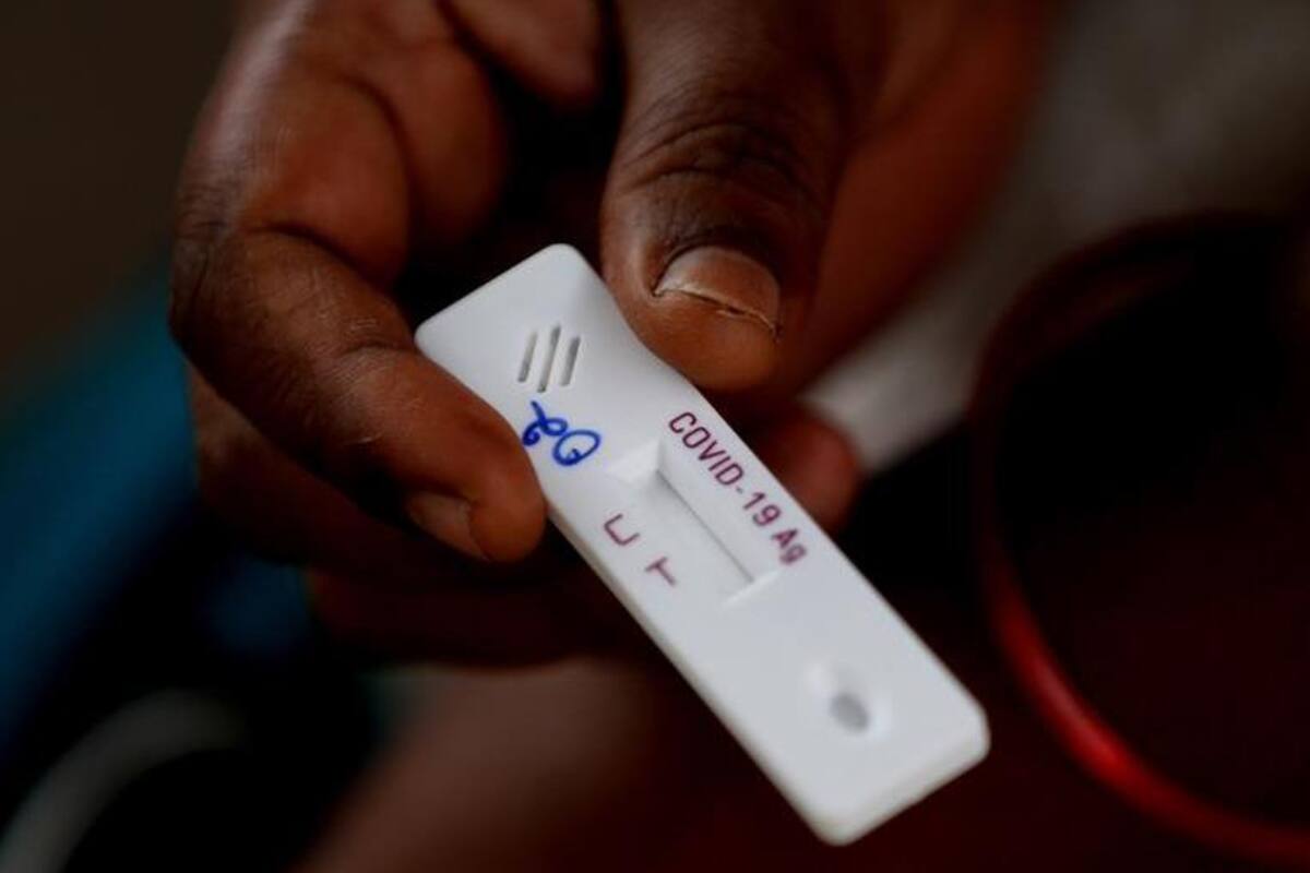 Llegan a 30.4 millones los casos de Covid-19 en el mundo: OMS