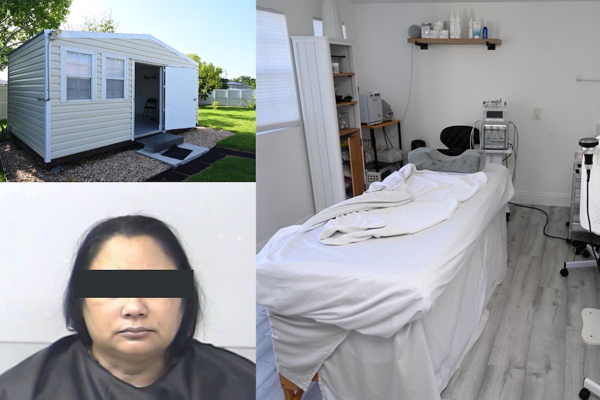 Mujer sufre parálisis facial tras inyecciones de Botox en una clínica improvisada