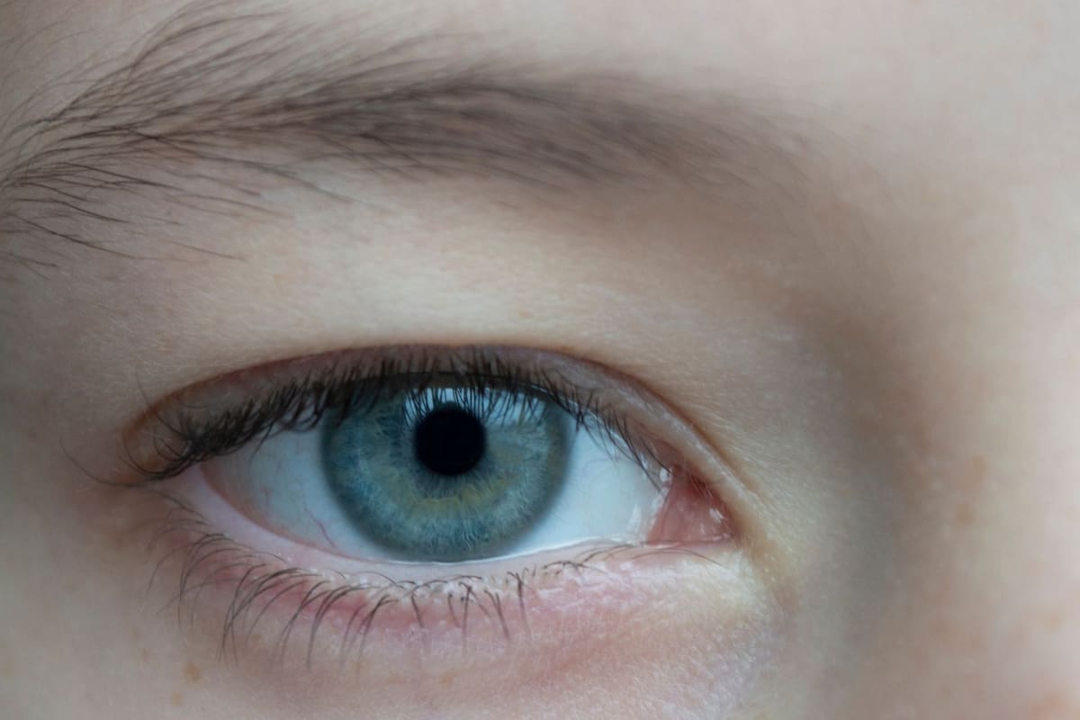 Megacórnea: la causa genética que agranda la apariencia del ojo