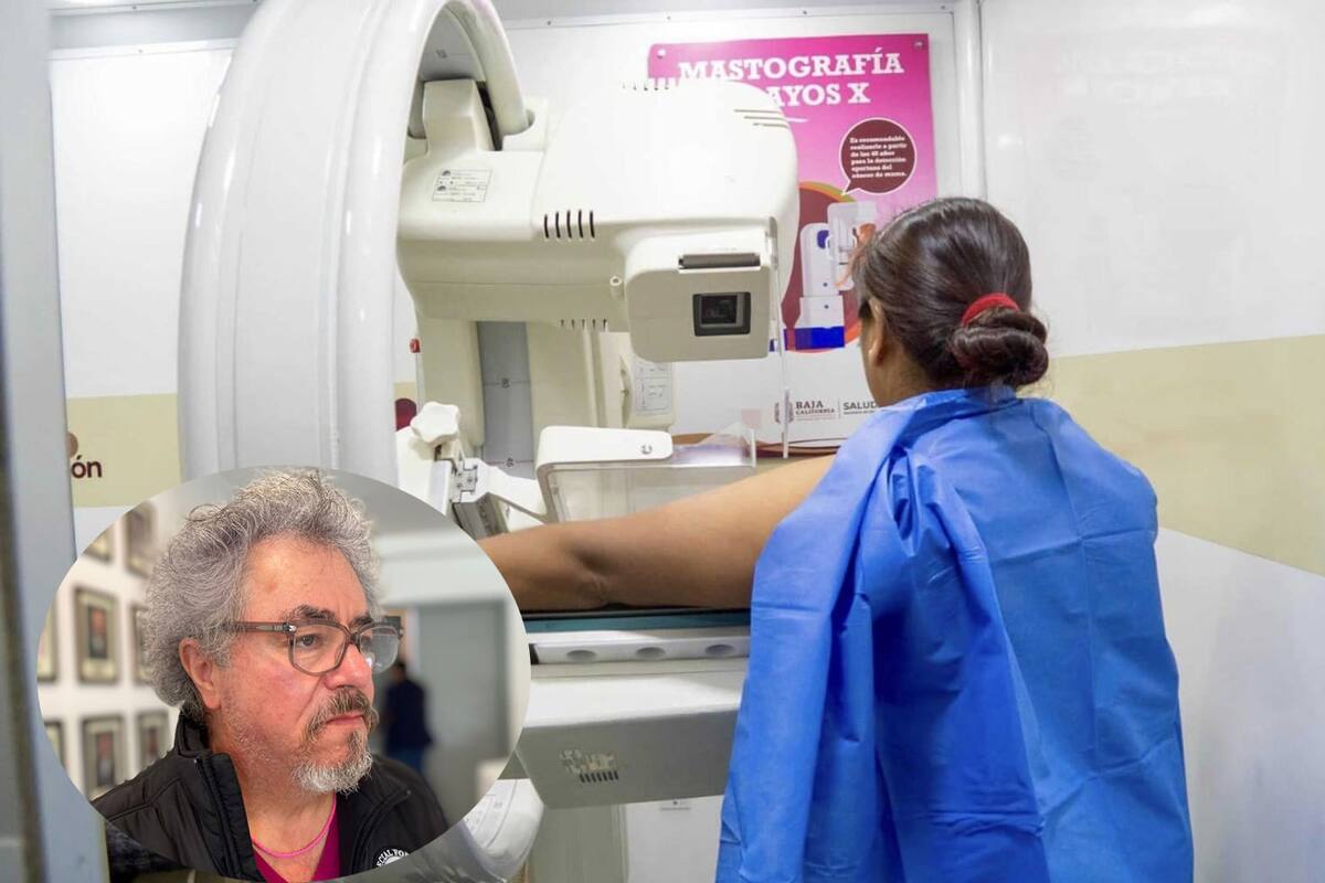 Falta de servicios médicos afecta diagnósticos de cáncer de mama