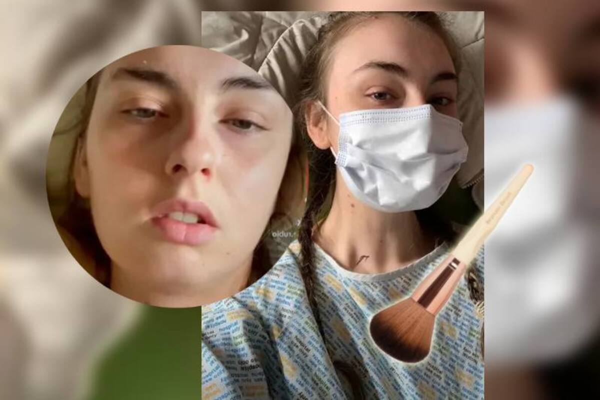 Joven creyó que era alérgica a su maquillaje y descubre que tenía cáncer: “entré en pánico y lloré”