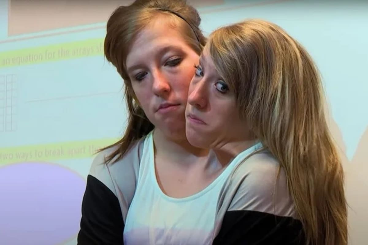 Abby y Brittany Hensel: la vida actual de las gemelas unidas que crecieron frente a las cámaras