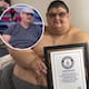 Murió el mexicano Juan Pedro Franco que con 595 kg tuvo el récord de la persona más obesa del mundo pero perdió 445 kilos con una exitosa operación que muchos creían imposible, vivió con un padecimiento que le impedía controlar su peso