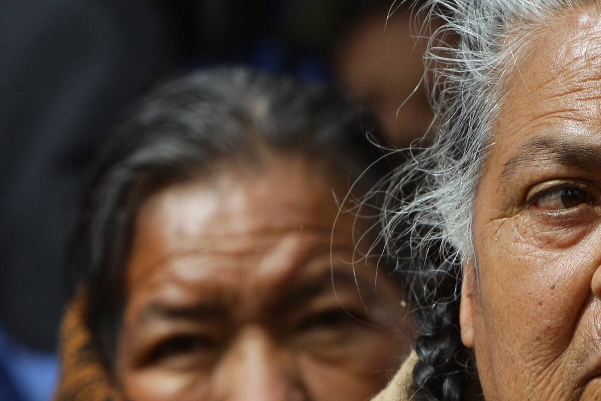 Una de cada tres mexicanas mayores de 50 años padece osteoporosis
