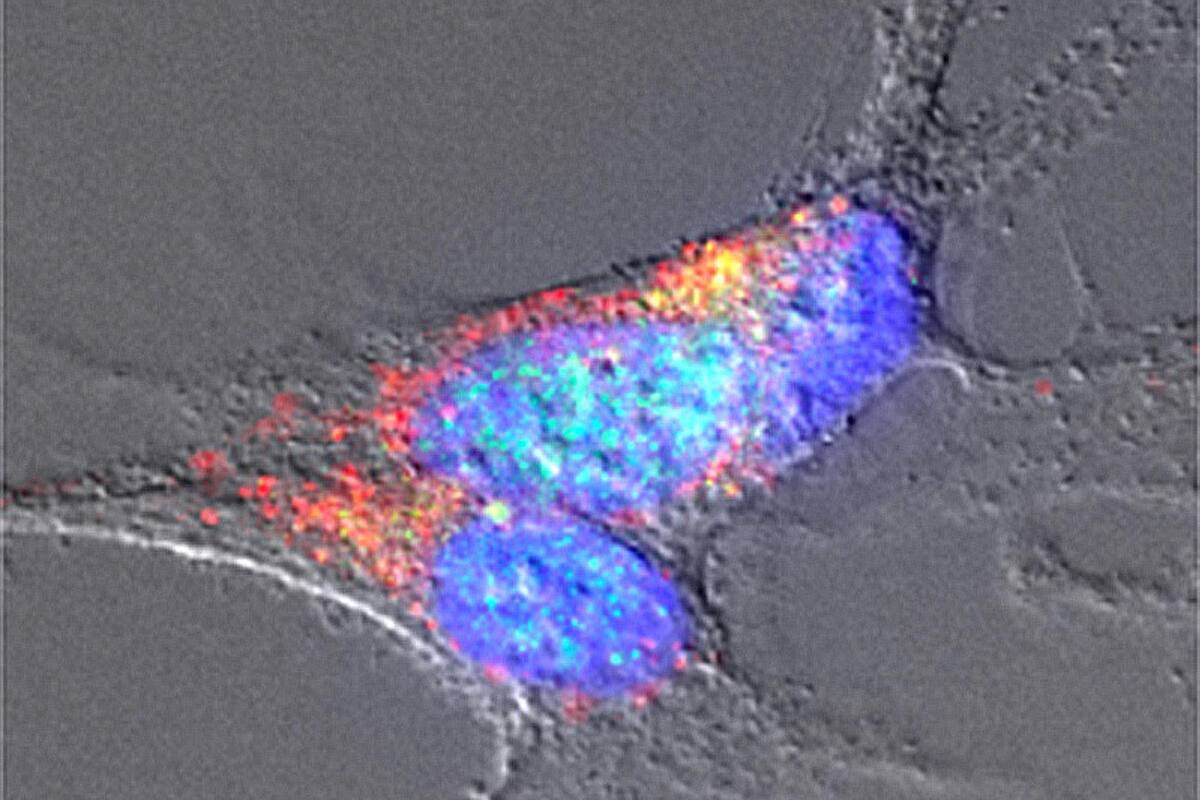 Relacionan alteración de la flora intestinal con Parkinson