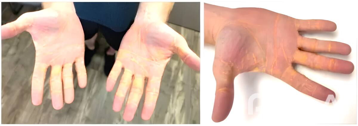 Imagenes tomadas de JAMA Cardiology