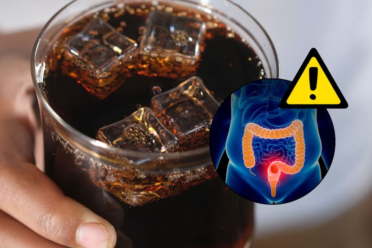 ¿Tomar bebidas azucaradas todos los días aumenta el riesgo de cáncer de estómago? Esto encontró un estudio