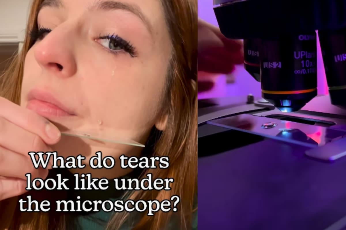 ¿Cómo lucen nuestras lágrimas bajo el microscopio? Joven se vuelve viral al descubrirlo