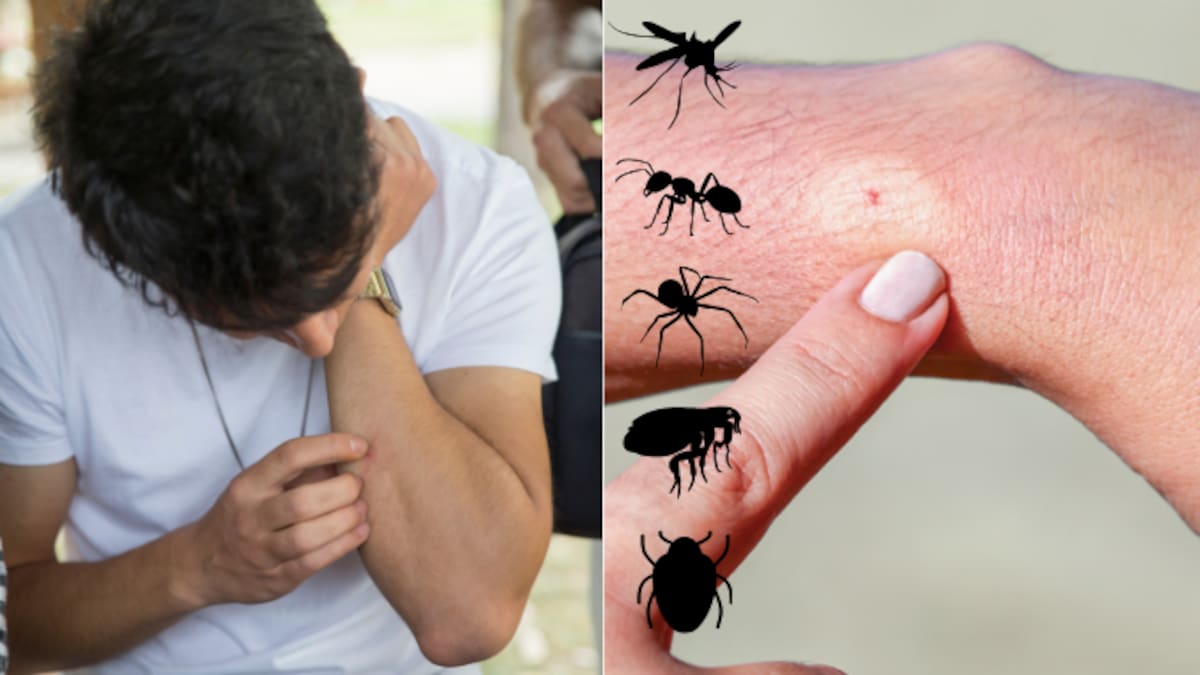 Calor y lluvias aumentan las picaduras de insectos: esta guía te ayuda a distinguir si fue un mosquito, una araña, una chinche, una pulga o una hormiga