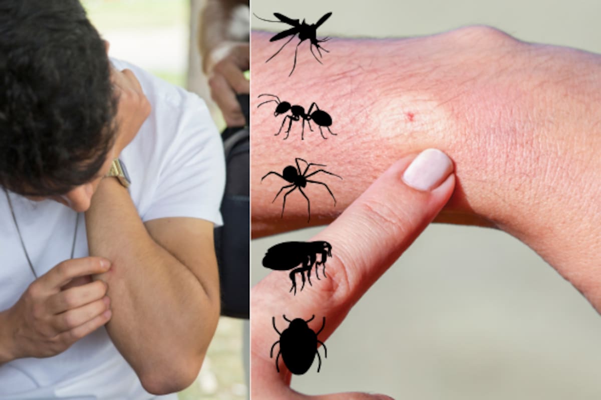Calor y lluvias aumentan las picaduras de insectos: esta guía te ayuda a distinguir si fue un mosquito, una araña, una chinche, una pulga o una hormiga