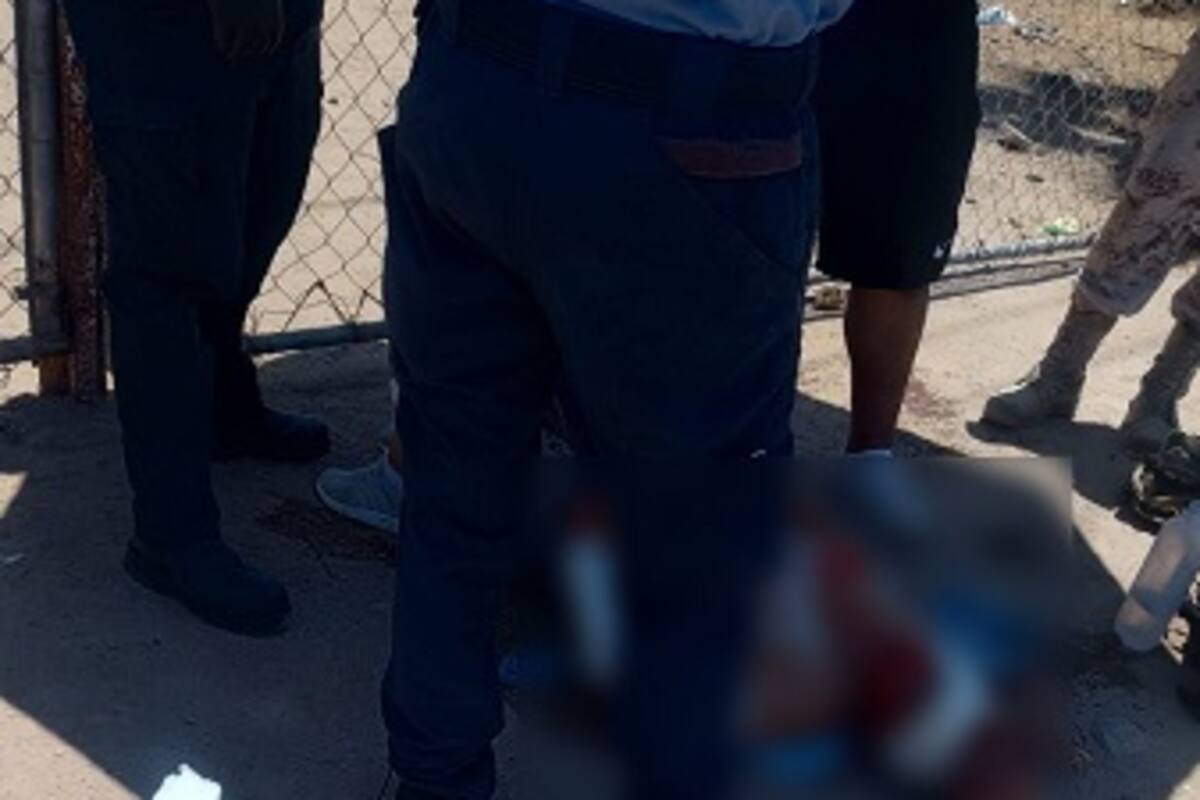 Mujer es atacada por perros en el ejido Jiquilpan