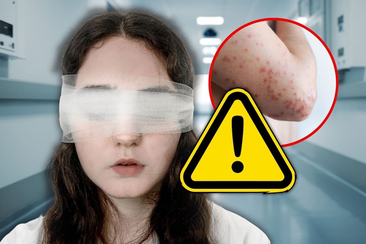 Sarampión puede causar ceguera y sordera, alertan especialistas ante el brote en México y refuerzan llamado a la vacunación