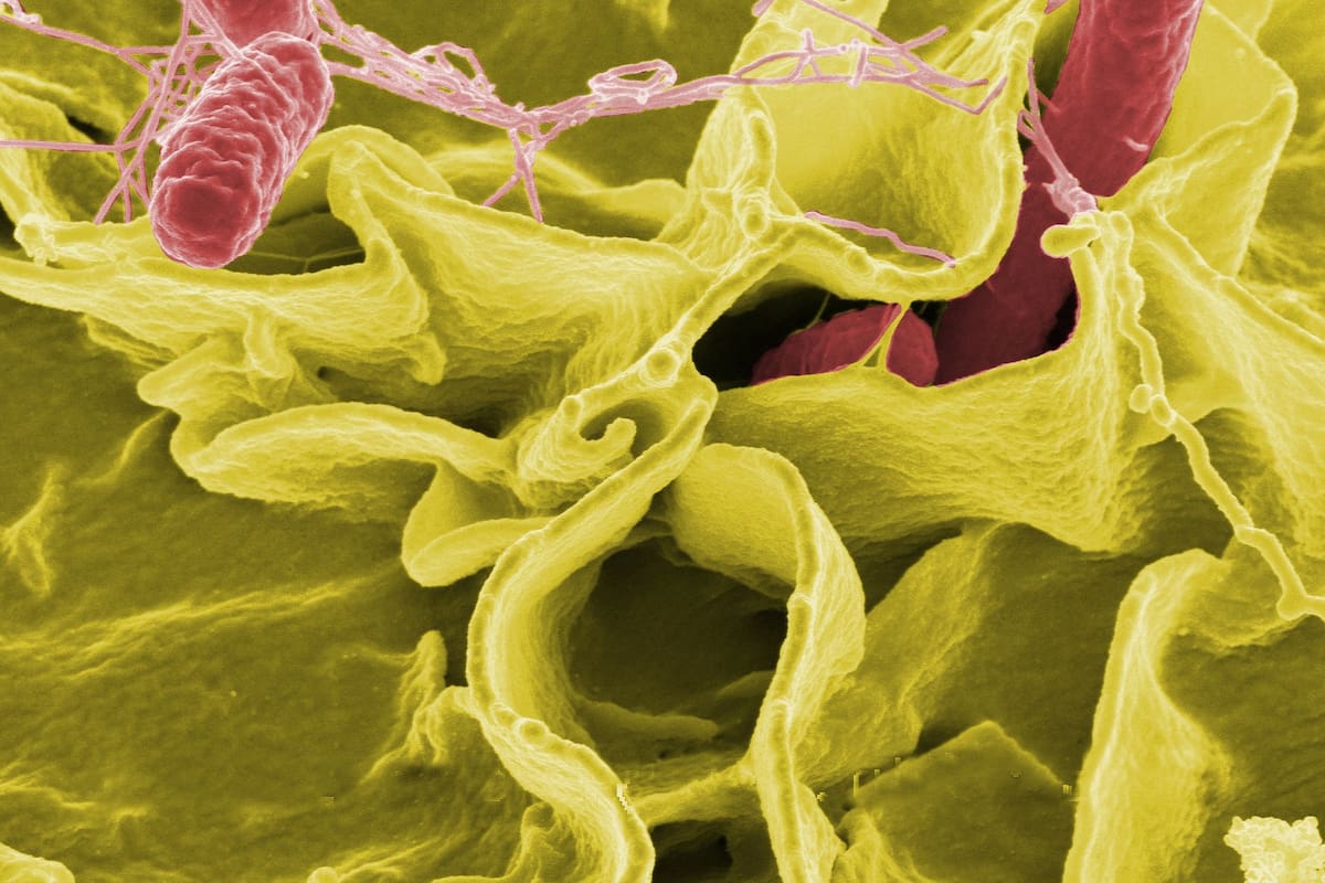 Científicos encuentran bacterias “invisibles” para nuestro sistema inmunológico