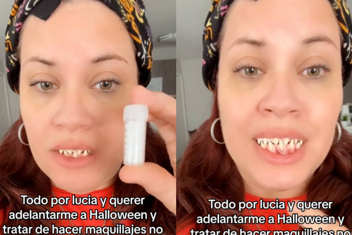 Mujer se pone una dentadura postiza de Halloween, ¡pero luego no se la puede quitar! | VIRAL