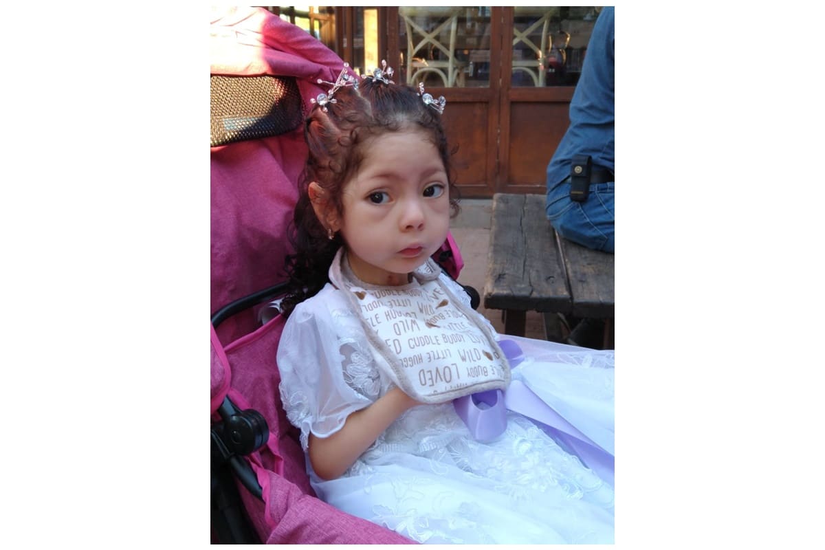 Romina es una pequeña gran guerrera: nació con una extraña condición, única en el mundo