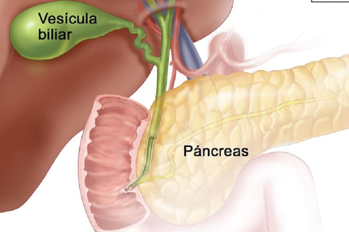 Cuida vesícula y páncreas, evita el consumo de grasas y alcohol en exceso