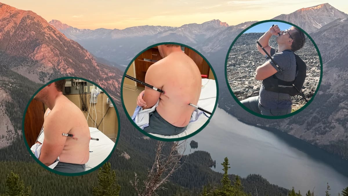 Un enfermero de 32 años sobrevivió tras empalmarse con su bastón en la montaña más alta de Montana, caminando 16 kilómetros con la herida durante siete horas antes de llegar al hospital donde trabaja, en un caso que expone los riesgos extremos del senderismo sin comunicación de emergencia