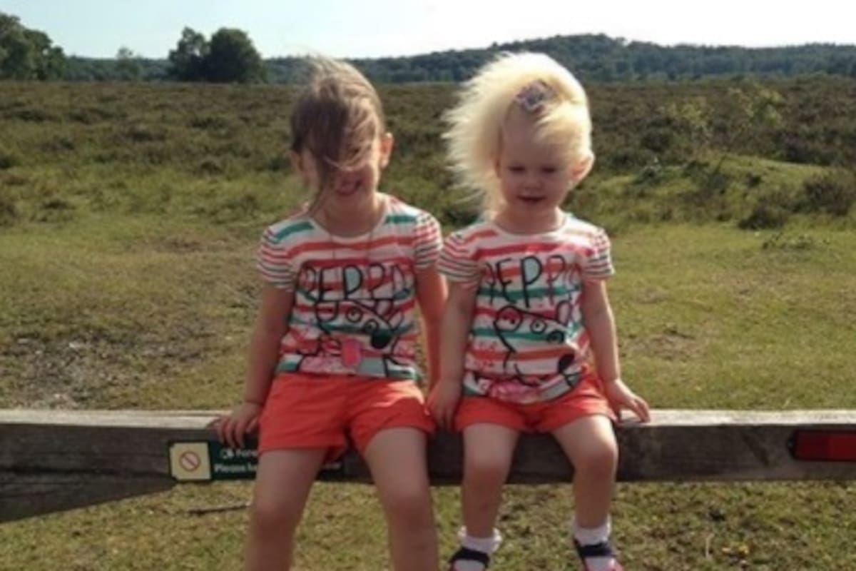 Niña con síndrome del cabello impeinable logra manejar su pelo por primera vez en 9 años