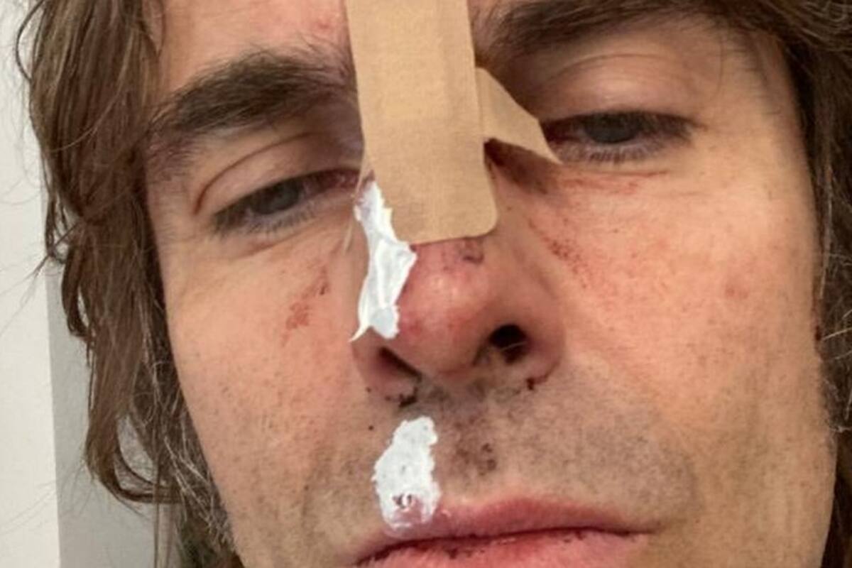 La foto que compartió Liam Gallagher, exlíder de Oasis, tras "caerse de un
helicóptero"