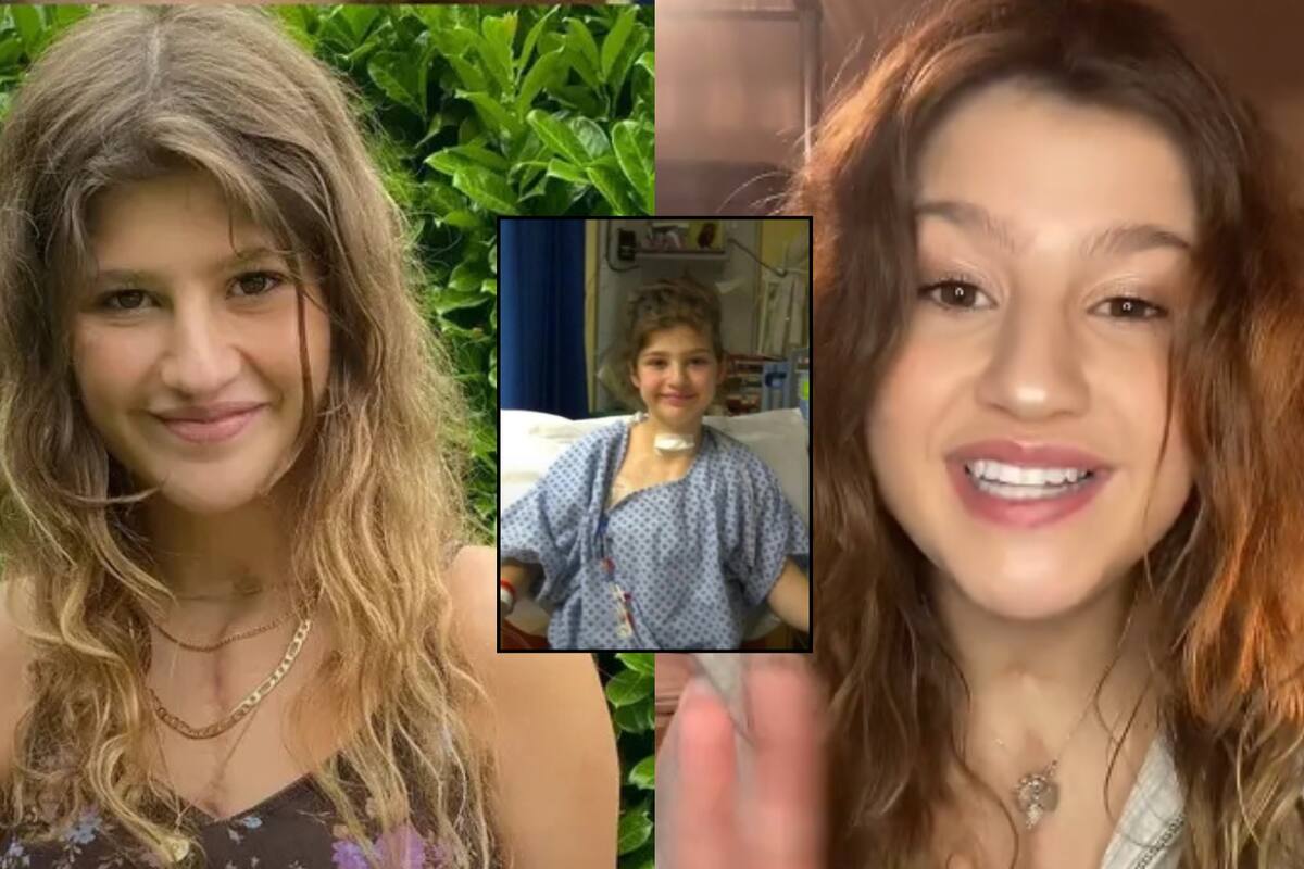 VIDEO: Joven sobreviviente de trasplante de corazón se vuelve viral al mostrar cómo su corazón late a través de su pecho