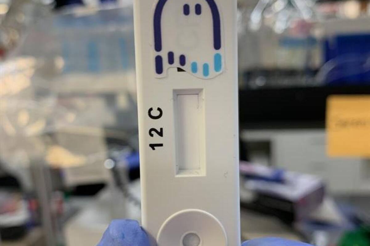 Desarrollan en Argentina un test para detectar el coronavirus en una hora
