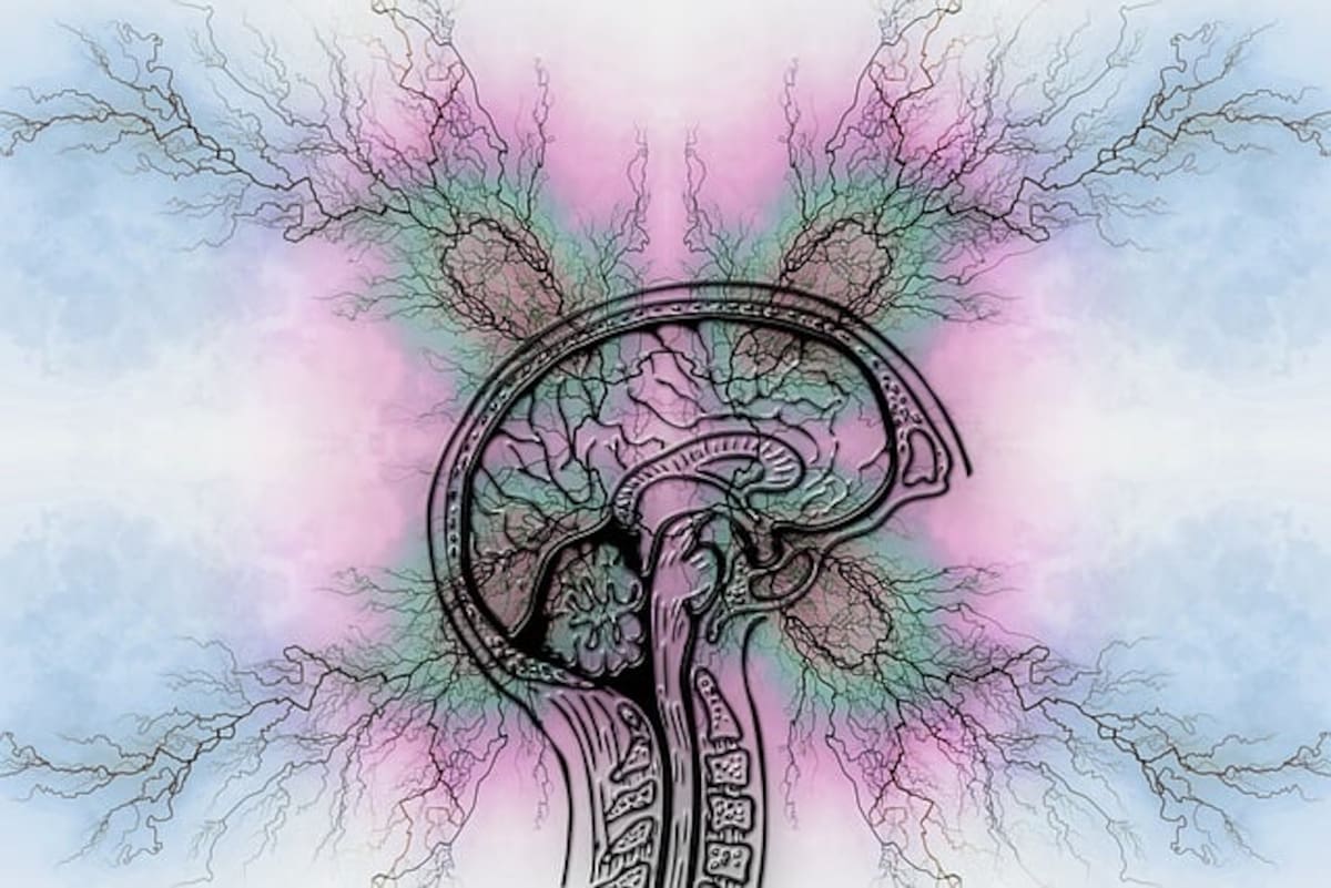 La epilepsia es un trastorno neurológico crónico que se caracteriza por crisis epilépticas recurrentes.