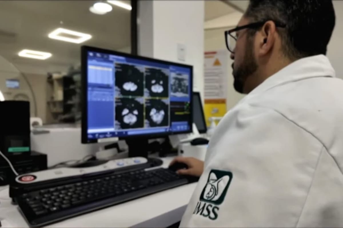 Dolor de cabeza intenso, mareos y pérdida de fuerza: síntomas que podrían alertar sobre un problema neurológico