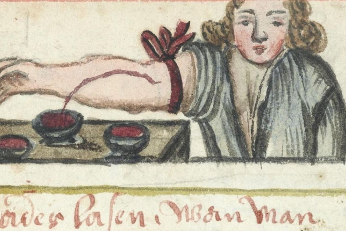 La “sangría” en la Edad Media: un extraño arte de curación a través de la extracción de sangre